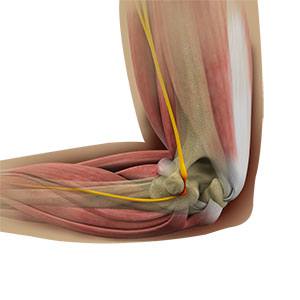 Cubital Tunnel Release (Medial Epicondylectomy)