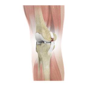 Knee Ligament Reconstruction
